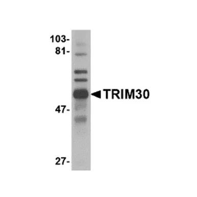 geneseesci20260712005443890376